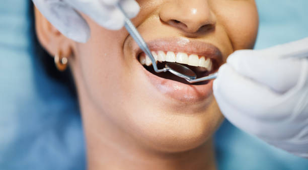 Best After-Hours Emergency Dentist in Connell, WA