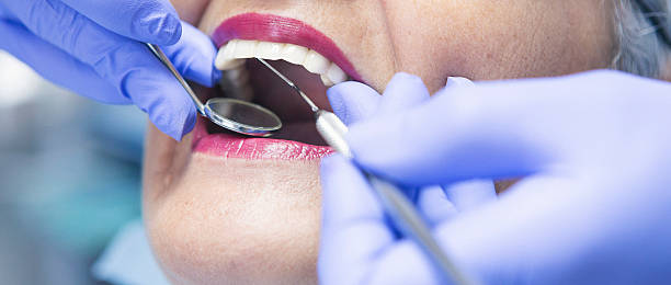 Best Emergency Tooth Extraction in Connell, WA